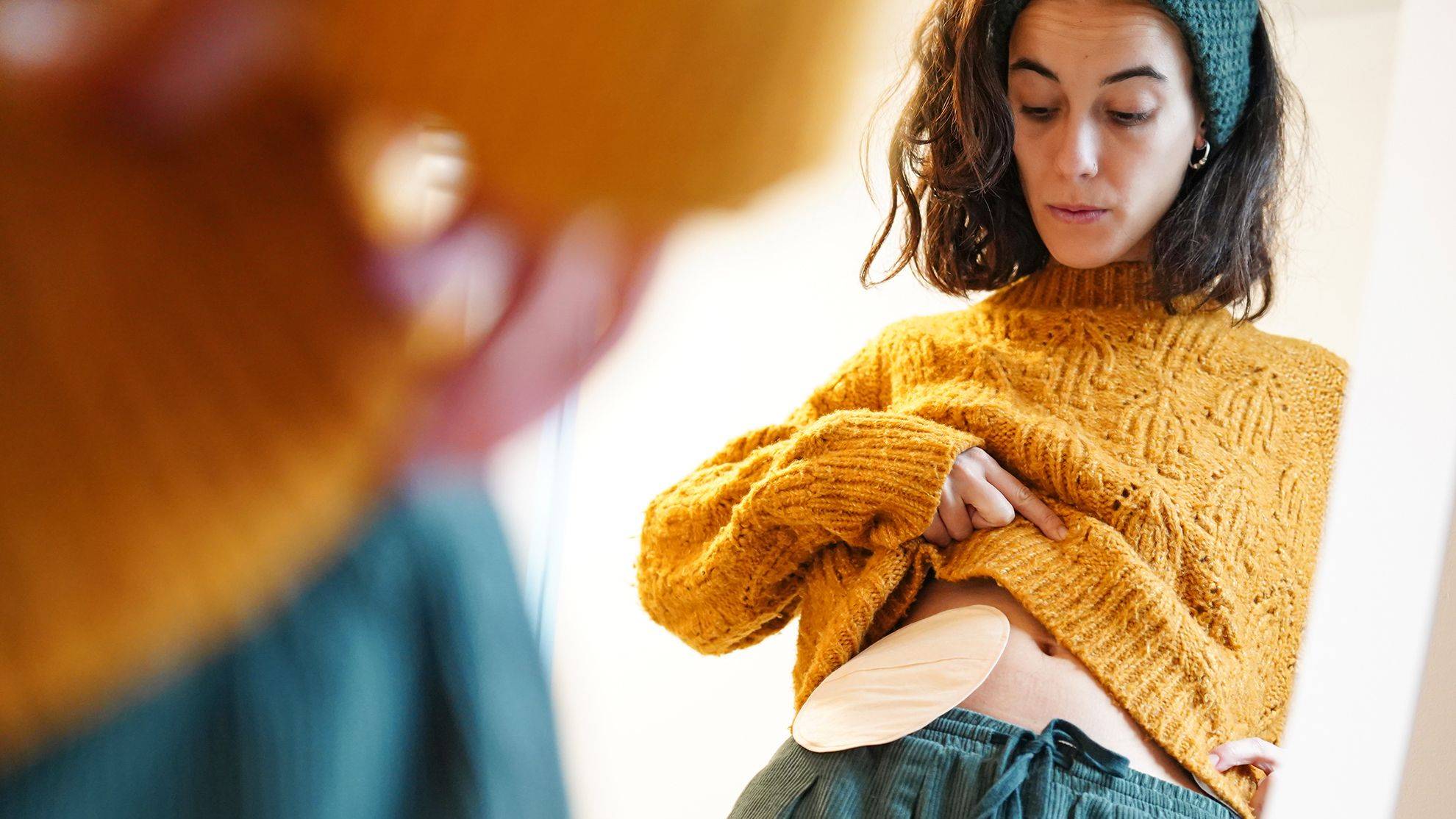Patientin zieht ihren Pullover ein Stück hoch, so dass man ihren am Bauch befestigten Stomabeutel sehen kann.